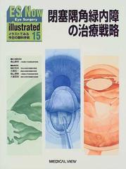 ｅｓ ｎｏｗ ｉｌｌｕｓｔｒａｔｅｄ イラストでみる今日の眼科手術 １５ 閉塞隅角緑内障の治療戦略の通販 樋田 哲夫 桑山 泰明 紙の本 Honto本の通販ストア