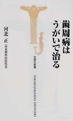 歯周病はうがいで治るの通販/河北 正 宝島社新書 - 紙の本：honto本の