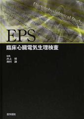 ＥＰＳ 臨床心臓電気生理検査