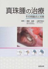 真珠腫の治療 その問題点と対策