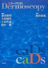 カラーアトラスdermoscopy [単行本] 池田重雄; 斎田俊明ISBN13