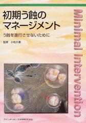 初期う蝕のマネージメント う蝕を進行させないためにの通販/小松 久憲