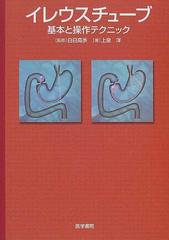 イレウスチューブ 基本と操作テクニックの通販/上泉 洋/白日 高歩 - 紙の本：honto本の通販ストア