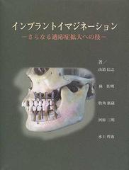 林佳明143 インプラントイマジネーション : さらなる適応症拡大