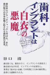 歯科 インプラントは白衣の悪魔の通販 谷口 清 紙の本 Honto本の通販ストア