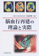 脳血行再建の理論と実際