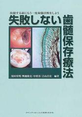 失敗しない歯髄保存療法 抜髄する前にもう一度歯髄診断をしよう