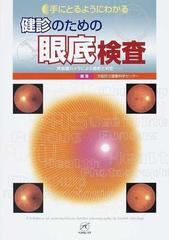 手にとるようにわかる健診のための眼底検査 無散瞳カメラによる