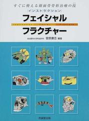 インストラクション・フェイシャルフラクチャー すぐに使える顔面骨骨折治療の技