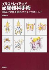 イラストレイテッド泌尿器科手術 : 図脳で覚える術式とチェックポイント-