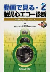 動画で見る・胎児心エコー診断 ２ 流出路からのスクリーニング