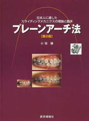 プレーンアーチ法 日本人に適したスライディングメカニクスの理論と臨床 第２版