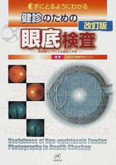 手にとるようにわかる健診のための眼底検査 無散瞳カメラによる撮影と 