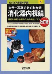 カラー写真で必ずわかる！消化器内視鏡 適切な検査・治療のための手技