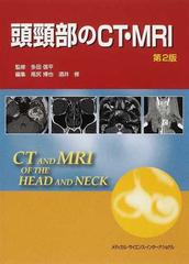 頭頸部のCT・MRI 第3版 | 尾尻博也, 酒井 修 |本 | 通販 | Amazon