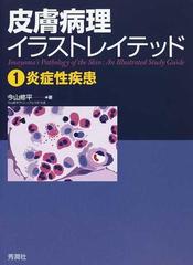 皮膚病理イラストレイテッド １ 炎症性疾患の通販 今山 修平 紙の本 Honto本の通販ストア