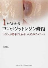 １からわかるコンポジットレジン修復 レジンが簡単にとれないためのテクニック