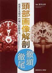 頭部画像解剖徹頭徹尾 疾患を見極め的確に診断する