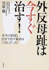 外反母趾は今すぐ治す 本当の原因と自分で治す秘訣は これ だった の通販 笠原 巖 紙の本 Honto本の通販ストア