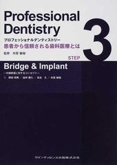 プロフェッショナルデンティストリー 患者から信頼される歯科医療とは ＳＴＥＰ３ Ｂｒｉｄｇｅ ＆ Ｉｍｐｌａｎｔ