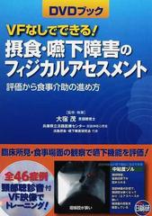 ＶＦなしでできる！摂食・嚥下障害のフィジカルアセスメント 評価から