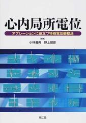 心内局所電位 アブレーションに役立つ特殊電位観察法