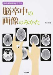 症状・経過観察に役立つ脳卒中の画像のみかた