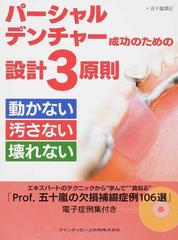 パーシャルデンチャー成功のための設計３原則 動かない汚さない壊れない