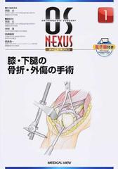 膝・下腿の骨折・外傷の手術 （ＯＳ ＮＥＸＵＳ）