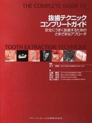 抜歯テクニックコンプリートガイド 安全にうまく抜歯するためのさまざまなアプローチ