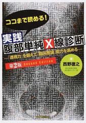 ココまで読める！実践腹部単純Ｘ線診断 「透視力」を鍛えて「臨床推論」能力を高める 第２版