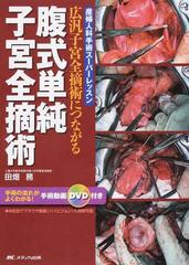 腹式単純子宮全摘術 広汎子宮全摘術につながる （産婦人科手術スーパーレッスン）