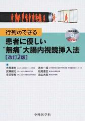 行列のできる患者に優しい“無痛”大腸内視鏡挿入法 改訂２版の通販/大西