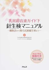 乳房超音波ガイド下針生検マニュアル 細胞診から吸引式組織生検までの通販 日本乳腺甲状腺超音波医学会インターベンション研究部会 紙の本 Honto本の通販ストア