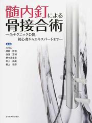 髄内釘による骨接合術 全テクニック公開，初心者からエキスパートまで