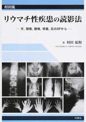 村田流リウマチ性疾患の読影法 手，頚椎，腰椎，骨盤，足のＸＰからの