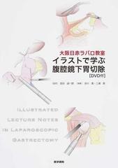 イラストで学ぶ腹腔鏡下胃切除 大阪日赤ラパロ教室