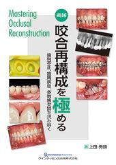 実践咬合再構成を極める 歯列不正、歯周疾患、多数歯欠損を読み解く