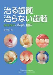 治る歯髄治らない歯髄 歯髄保存の科学と臨床