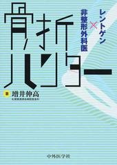 骨折ハンター レントゲン×非整形外科医