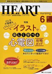 ハートナーシング ベストなハートケアをめざす心臓疾患領域の専門看護誌 第３３巻６号 ２０２０ ６ どんな不整脈もどんとこい イラストで楽しく学べる 心電図攻略ガイドの通販 紙の本 Honto本の通販ストア