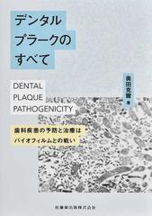 デンタルプラークのすべて 歯科疾患の予防と治療はバイオフィルムとの戦い