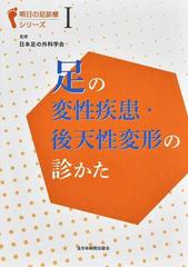 足の変性疾患・後天性変形の診かた （明日の足診療シリーズ）