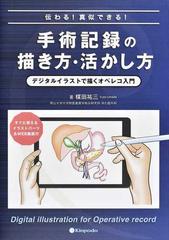 伝わる！真似できる！手術記録の描き方・活かし方 デジタルイラストで描くオペレコ入門