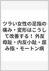 ツラい女性の足指の痛み・変形はこうして改善する！ 外反母趾・内反小趾・屈み指・モートン病