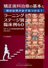 矯正歯科治療の基本と類似症例が必ず見つかる！ラーニング