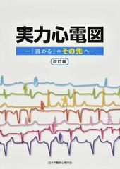 ランキング上位のプレゼント 【memeたん】実力心電図 「読める」のその