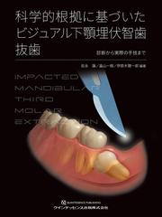 科学的根拠に基づいたビジュアル下顎埋伏智歯抜歯 診断から実際の手技 