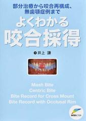 よくわかる咬合採得 部分治療から咬合再構成、無歯顎症例まで
