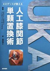 エビデンスが教える人工膝関節単顆置換術